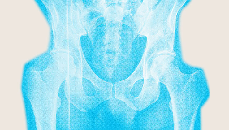 Kemiklerinizi güçlendirmek için menopoza kadar beklemeyin