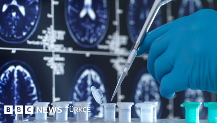 Alzheimer tedavisi virüslerde saklı olabilir mi? – BBC News Türkçe