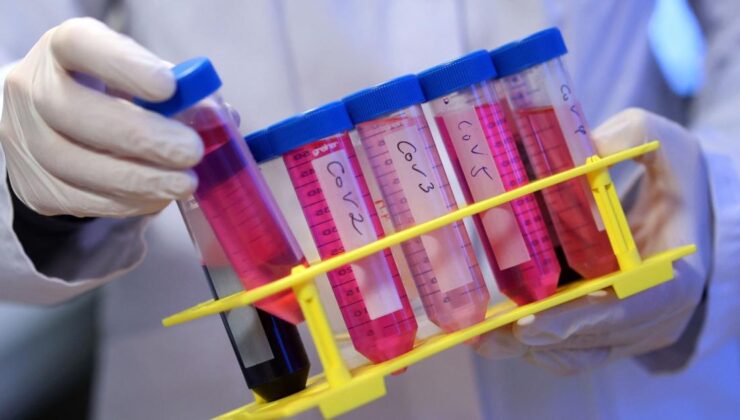 Uzun Kovid’in etkileri Parkinson ve felce benziyor