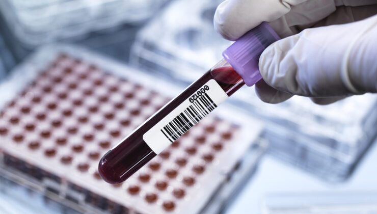 Genetik testlerde en büyük risk: Yanlış yorum