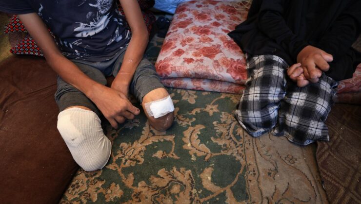 BM Komiseri: 7 Ekim'den bu yana Gazze'de 4 bin çocuk ampute edildi