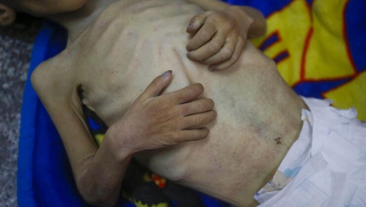 Gazze'de açlıktan ölenlerin sayısı 367'ye çıktı