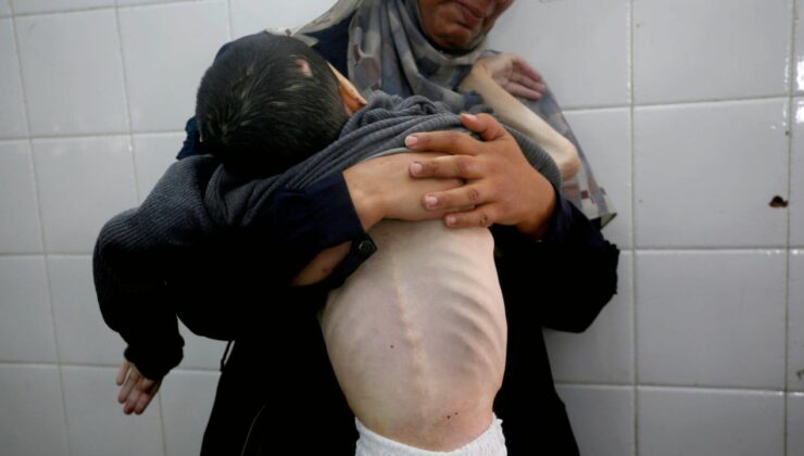 Gazze’de açlıktan ölenlerin sayısı 339’a çıktı