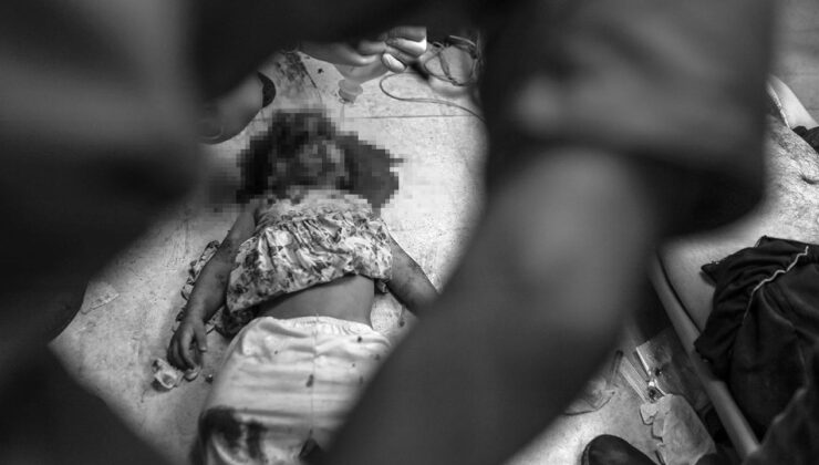 Katil İsrail’in saldırıları Gazze’de hastaneleri çökertti: Doktorlar ameliyatları anestezisiz yapıyor