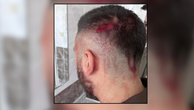 Şanlıurfa’da okulda öğretmene sopalı saldırı