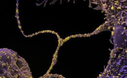 İyileşen COVID-19 Hastalarının Taramaları Beyindeki Mikroyapısal Değişiklikleri Ortaya Çıkardı