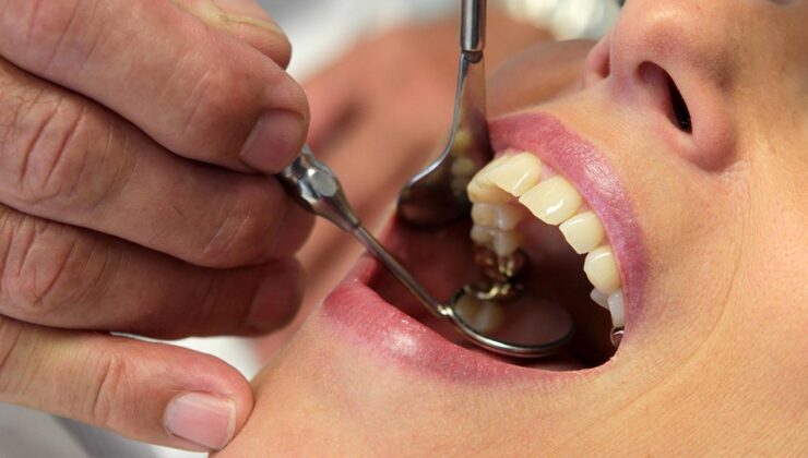 İlerleyen diş çürüğü sistemik hastalıkları tetikleyebilir