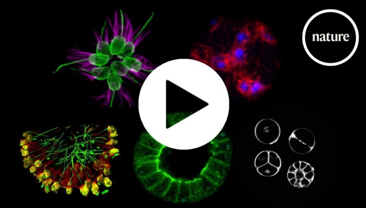 Çok hücrelilikle uğraşan beş tek hücreli tür