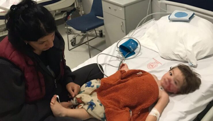 Ankara'da pitbull 2 çocuğa saldırdı