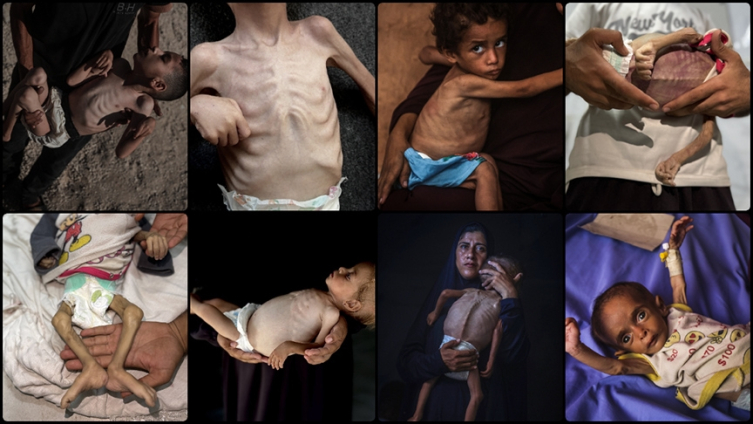 Batıya göre Gazzede hayat hiyerarşisi: Eşekler çıktı, çocuklar kaldı