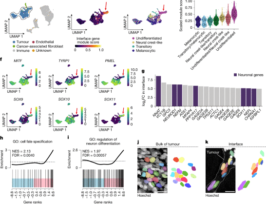 Mekanik sınırlama melanomda fenotipik plastisiteyi yönetir