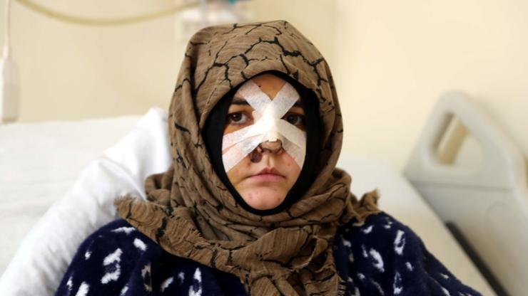 Kaldırım taşıyla öldüresiye dövüldü! Nazlı’nın yardım çığlığı – CNN TÜRK Son Haberler