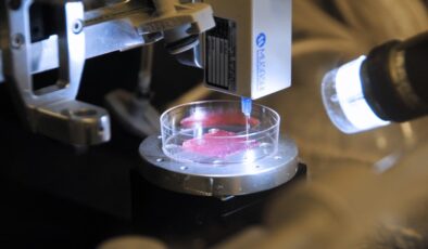 En son deri ikameleri yanıkların ve diğer yaraların tedavisinde devrim yaratacak mı?