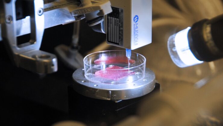 En son deri ikameleri yanıkların ve diğer yaraların tedavisinde devrim yaratacak mı?