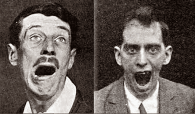 Ensefalit Lethargica: 500.000 Kişiyi Öldüren ve Sonra Aniden Ortadan Kaybolan Garip Hastalık