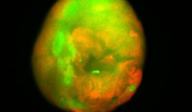 Laboratuvarda Yetiştirilen “Mini” İnsan Omuriliği Felç Tedavisine Doğru Büyük Adımda İyileşti