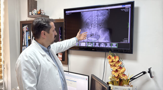 İdrar kanalından 51 taş çıkarıldı