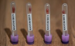 Sağlık Bakanlığı, Türkiye’ye getirilen yolcuların hantavirüs sonuçlarını açıkladı
