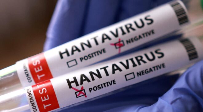 İngiltere: Bir İngiliz vatandaşında daha hantavirüs şüphesi tespit edildi