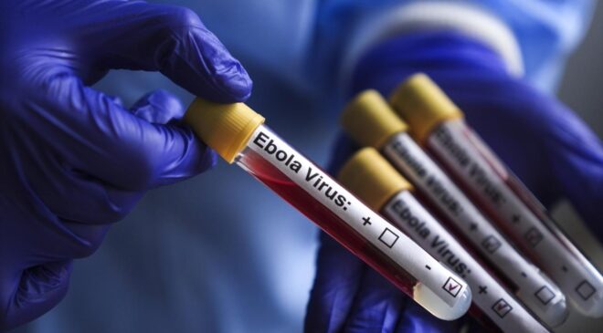 İsrail’de ilk kez Ebola şüphesiyle bir kişi karantinaya alındı