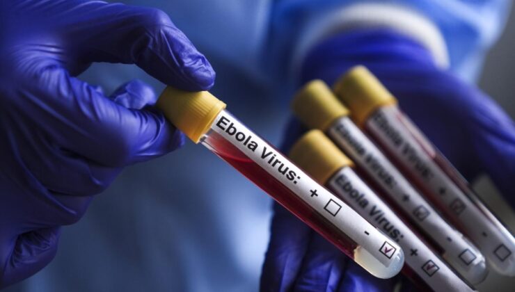 İsrail’de ilk kez Ebola şüphesiyle bir kişi karantinaya alındı