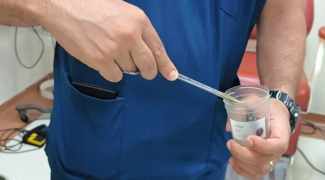 Dere suyu içen çocuğun boğazına sülük yapıştı: Doktordan uyarı