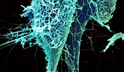 Ebola Ebola Salgını Vaka Sayısını Aştı, Fransa ve Uganda’da Tespit Edildi