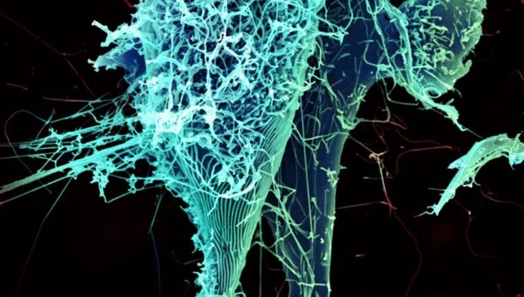 Ebola Ebola Salgını Vaka Sayısını Aştı, Fransa ve Uganda’da Tespit Edildi