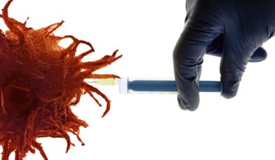 Rusya’nın ürettiği kanser aşısı ilk klinik testlerde olumlu sonuç verdi