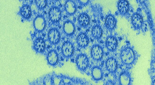İlk mRNA Grip Aşısı Nihayet FDA Tarafından 2026 Sezonu İçin Onaylandı – Başlangıçta İncelemeyi Reddettikten Sonra